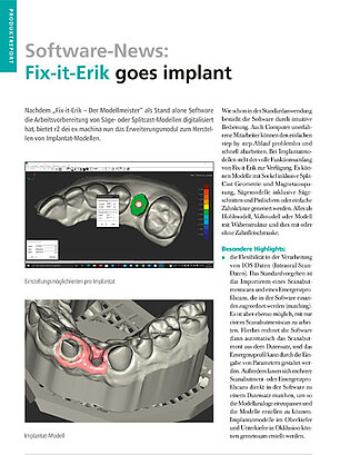 rr_artikel_fixiterik_implant